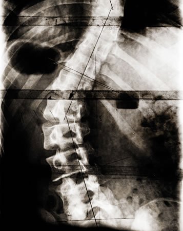 30 year-old male spinal x-ray
